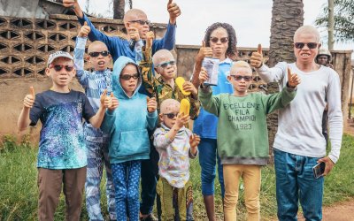 Scolarisation pour les enfants Albinos – Novembre 2020 et Aout 2021